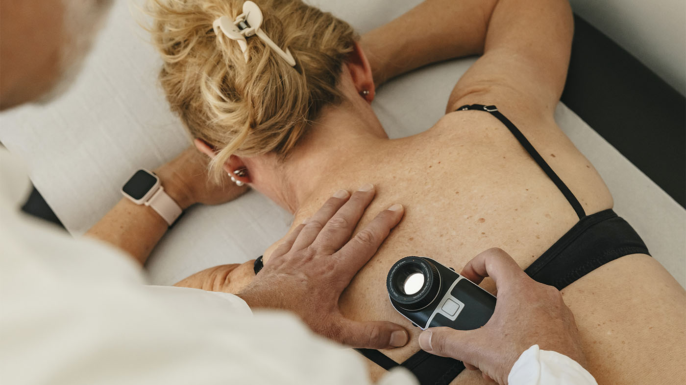  Hautkrebs-Untersuchung